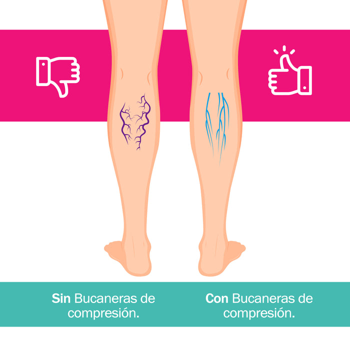 Infografia bucaneras compresion terapeutica modelo